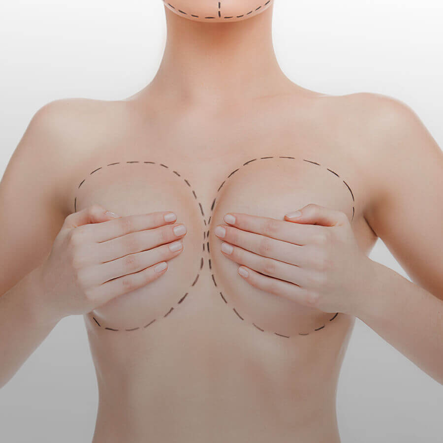 Breast <br><span>surgery</span>