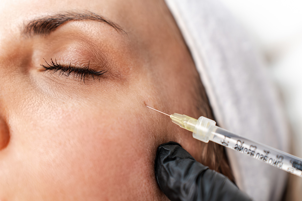 injection médecine esthétique